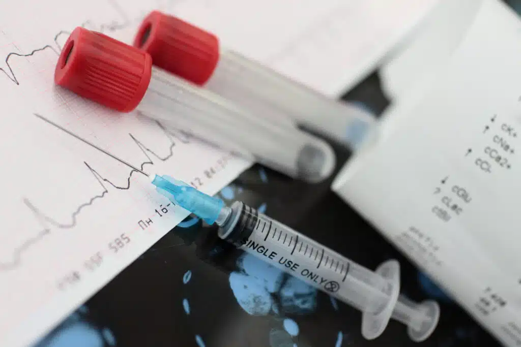atrial fibrillation