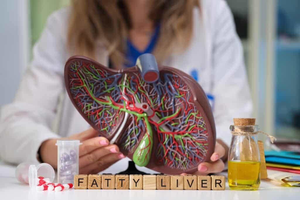 fatty liver disease
