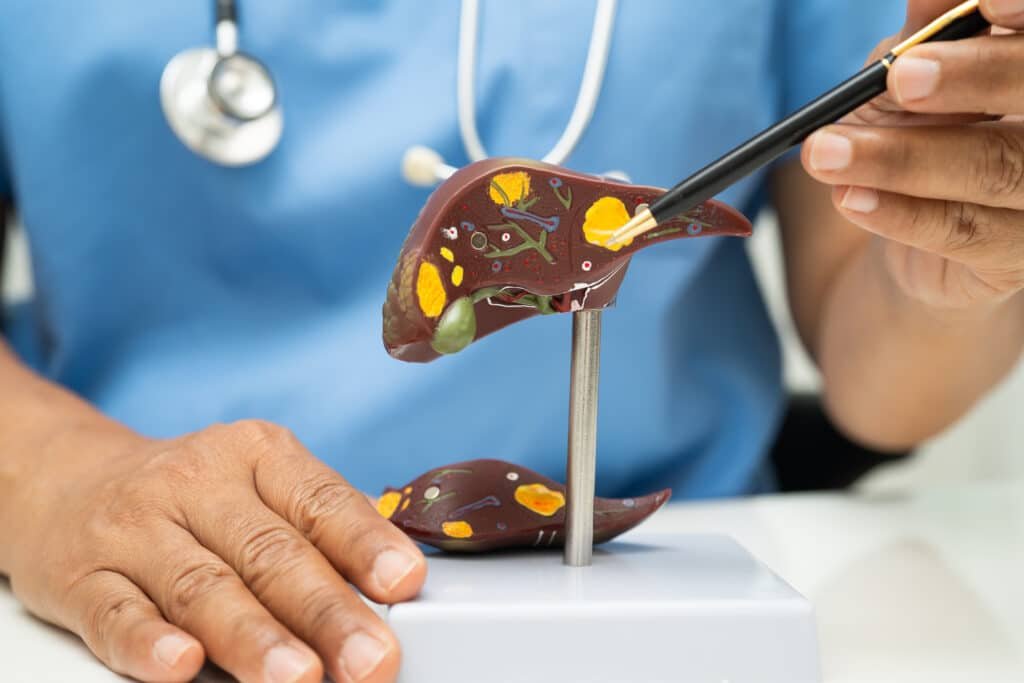 fatty liver disease